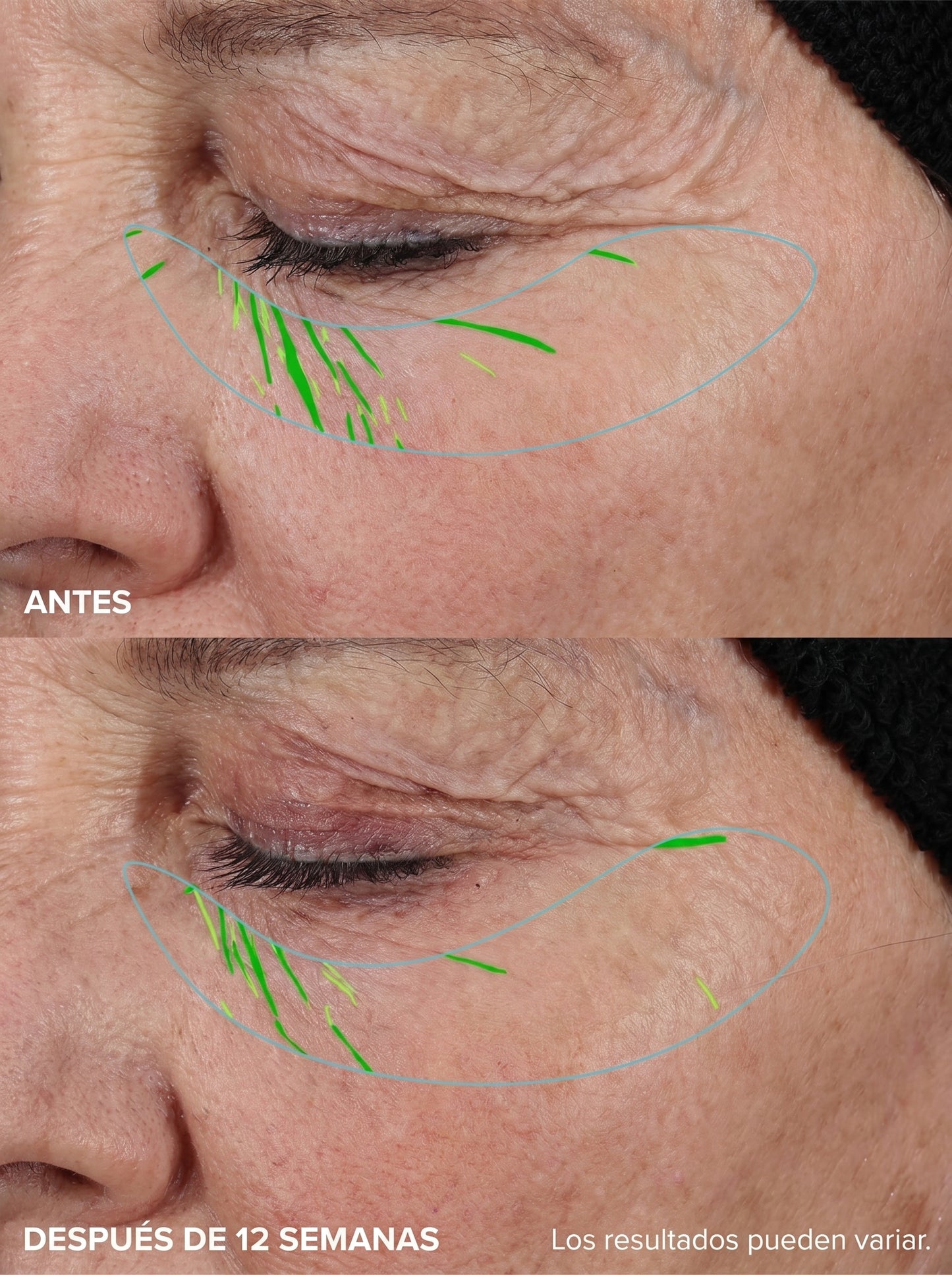 Velné™️Serum Anti-Age Sin Agujas