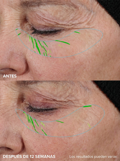 Velné™️Serum Anti-Age Sin Agujas